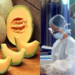 Salmonella Infection Melon became the cause of infectious disease