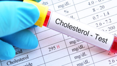 Cholestrol Test