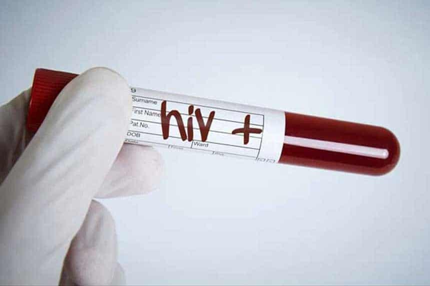 HIV+ve